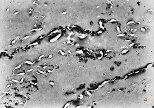 silver pigment among keratinized epidermal cells after application of silver nitrate